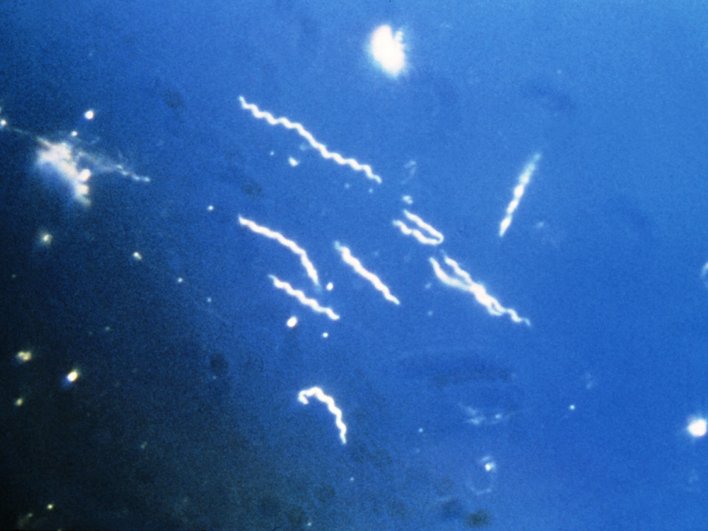Бактерия рода Borrelia Бактерия рода Borrelia