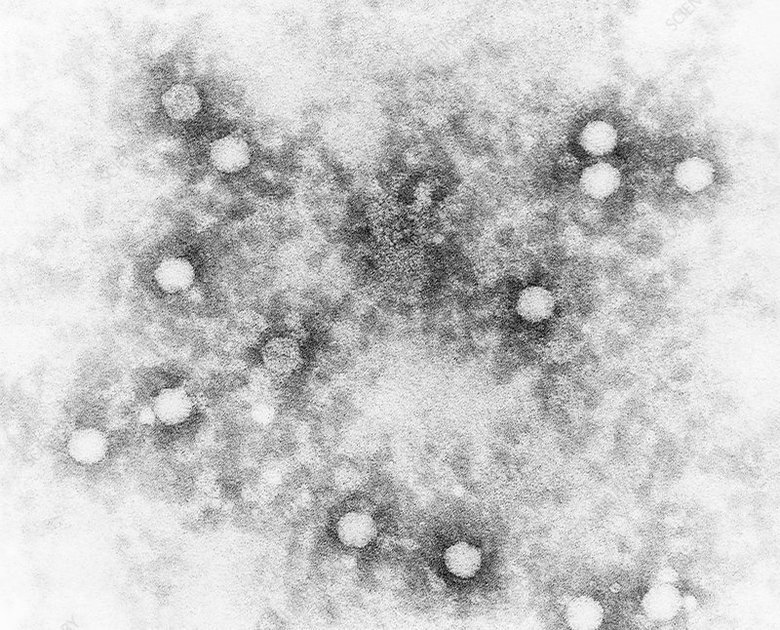 Микрофотография вирусов полиомиелита. Фото: Sciencephoto