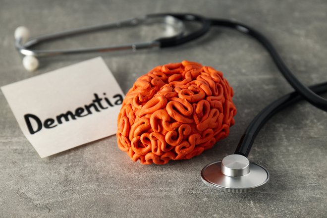 Деменция Деменция