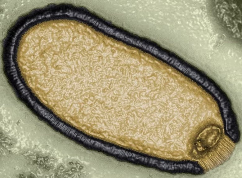 Компьютерное изображение вируса Pithovirus sibericum, выделенного из образца вечной мерзлоты возрастом 30 000 лет в 2014 году. Фото: Jean-Michel Claverie/IGS/CNRS-AM