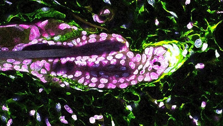 Клетки волосяного сосочка (зеленые) производят молекулу GAS6, которая активирует эпидермальные стволовые клетки