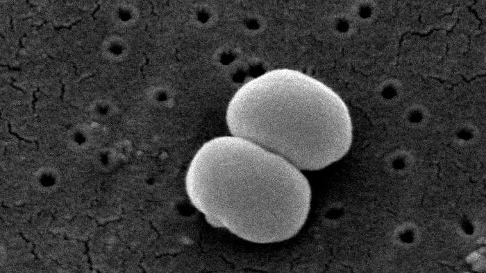 Staphylococcus epidermidis Staphylococcus epidermidis