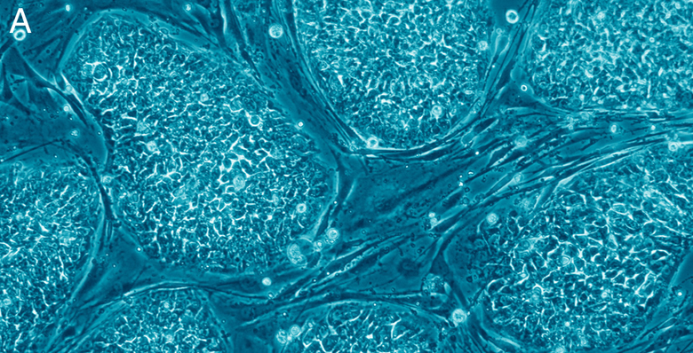 Эмбриональные стволовые клетки выглядят примерно так.