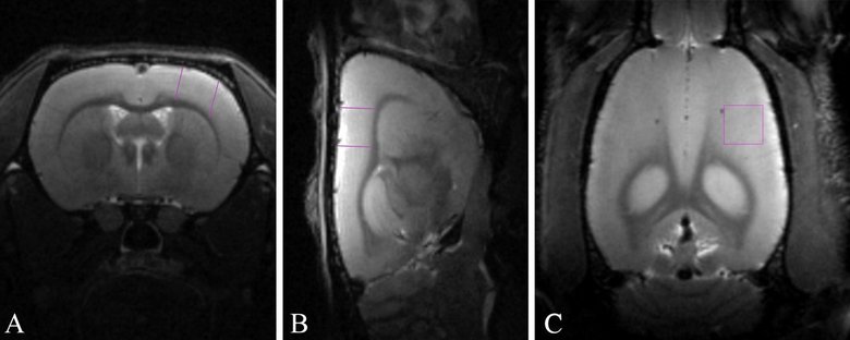 МРТ мозга крысы с выделенной областью анализа