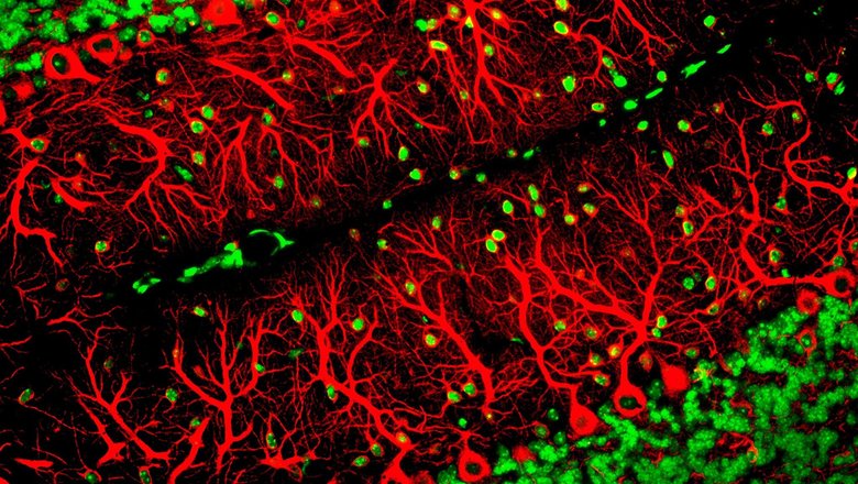 Клетки Пуркинье, один из основных типов нервных клеток, содержащихся в мозге. Фото: New York Times