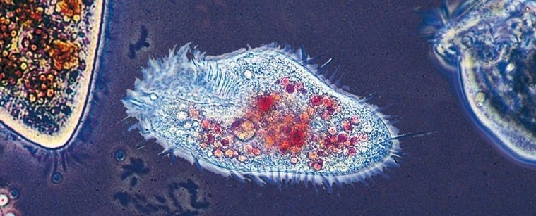 Euplotes eurystomus под микроскопом. Источник: sciencealert.com