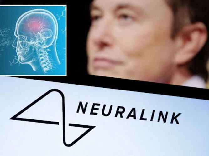 Neuralink планирует внедрять нейроинтерфейсы для лечения болезней Паркинсона, Альцгеймера, эпилепсии и даже психических расстройств, таких как депрессия и ОКР Neuralink планирует внедрять нейроинтерфейсы для лечения болезней Паркинсона, Альцгеймера, эпилепсии и даже психических расстройств, таких как депрессия и ОКР