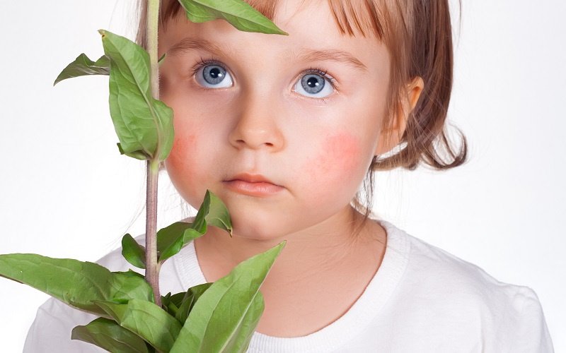 Аллергия на цветение березы у ребенка фото