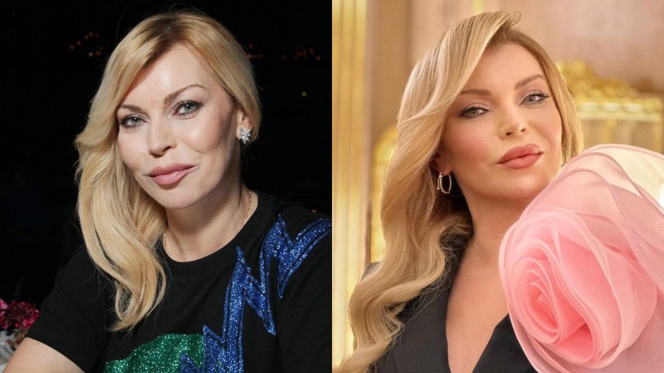 Лада Дэнс до и после пластики Лада Дэнс до и после пластики