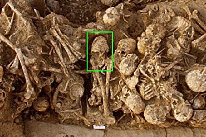 Женский череп конусовидной формы (фото: International Journal of Osteoarchaeology) Женский череп конусовидной формы (фото: International Journal of Osteoarchaeology)