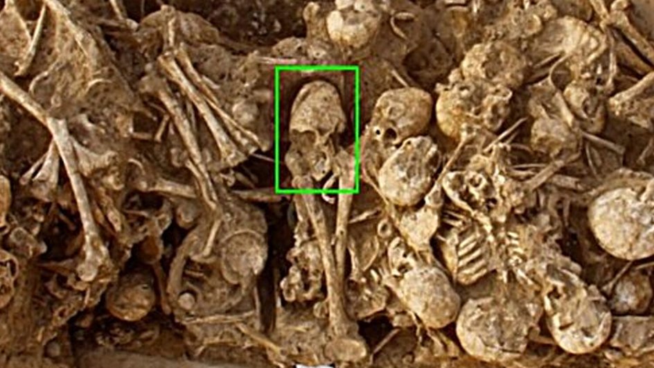Женский череп конусовидной формы (фото: International Journal of Osteoarchaeology) Женский череп конусовидной формы (фото: International Journal of Osteoarchaeology)