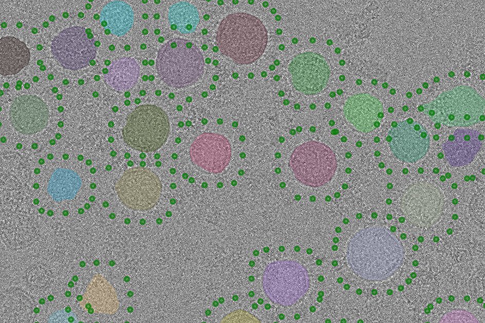 Экспериментальная электронная микрофотография очищенных синаптических везикул. Синаптические везикулы, автоматически идентифицированные на изображении с помощью новой компьютерной программы, выделены разными цветами, а позиции-кандидаты для V-АТФазы обозначены зелеными точками.