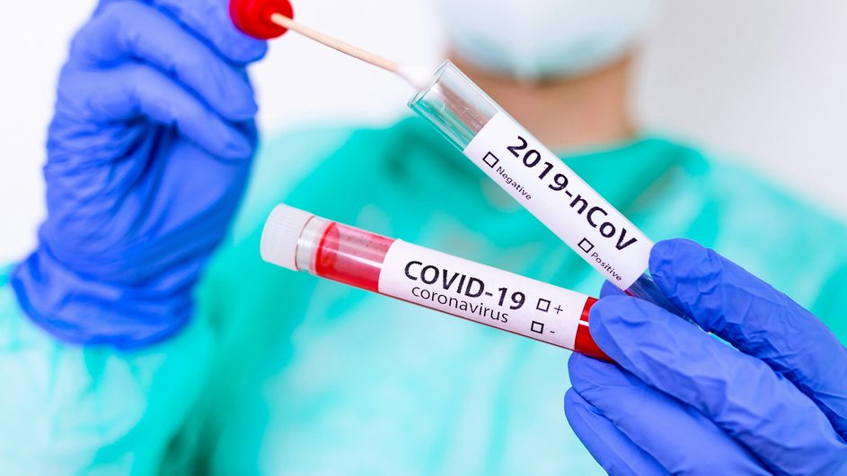 Анализы на Covid-19 Анализы на Covid-19