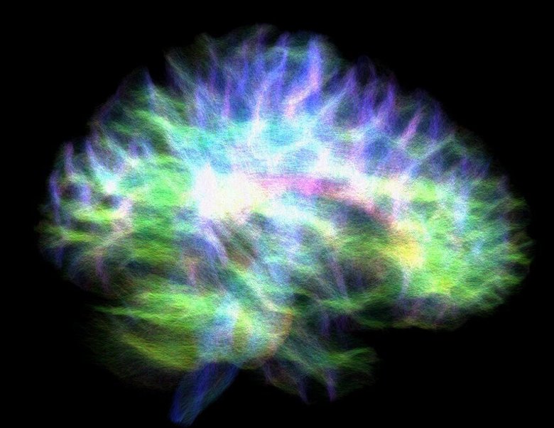Изображение «электрической схемы» человеческого мозга, показывающее связи с гиппокампом. Фото: Marshall Dalton/ University of Sydney