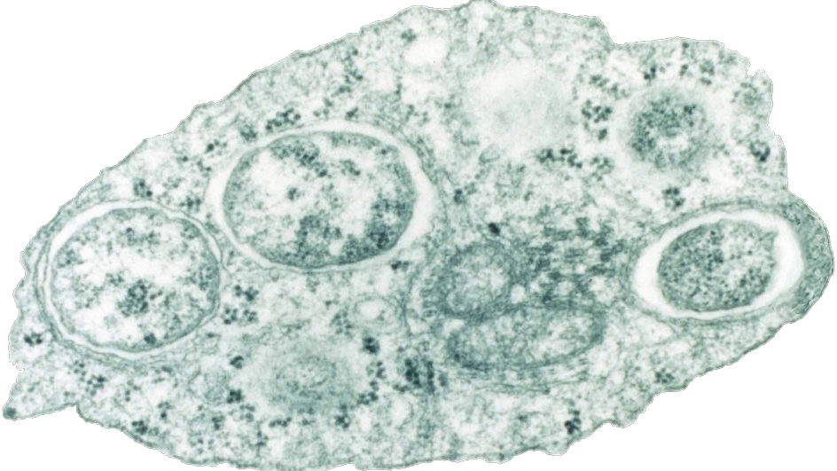Wolbachia под микроскопом Wolbachia под микроскопом