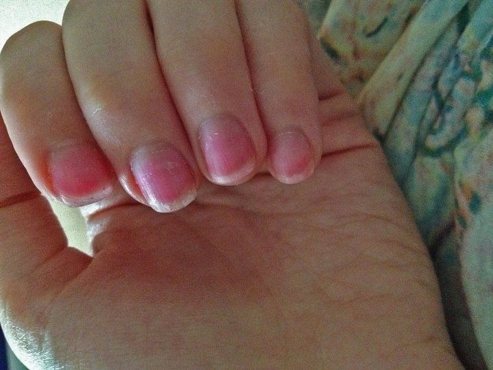 После снятия покрытия на ногтях остался тончайший слой интенсивно-розового цвета