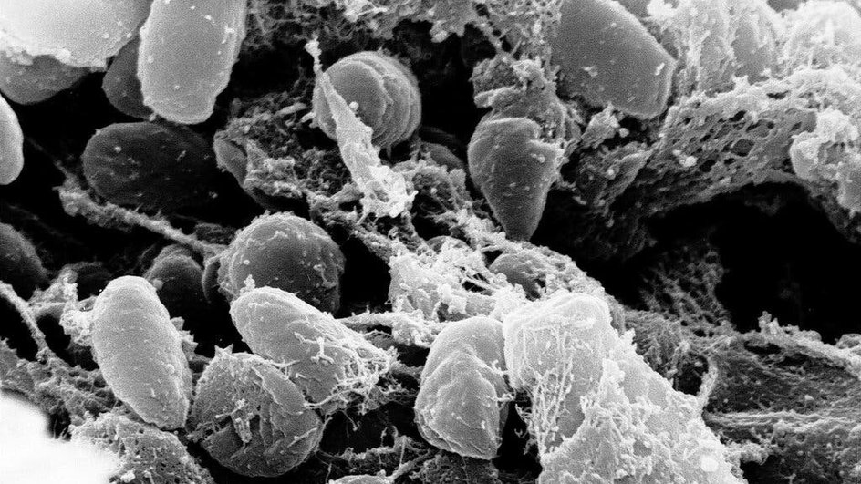 Yersinia pestis