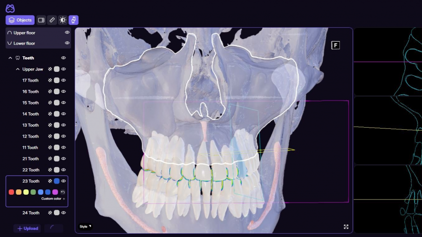 3D-проекция лицевых костей 3D-проекция лицевых костей