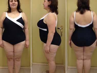 Slide image for gallery: 4867 | За пять месяцев программы Олеся Барабанова смогла похудеть на 21 кг, укрепила мышцы и стала намного выносливее