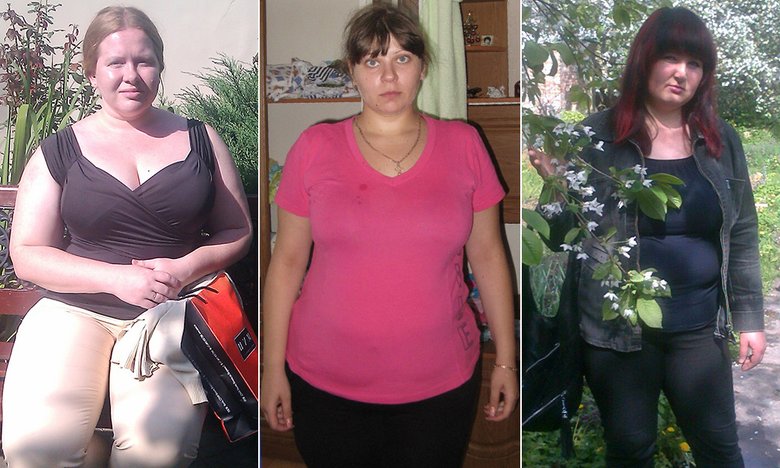 Так выглядят многие героини наших историй похудения до того, как расстанутся с лишними кг