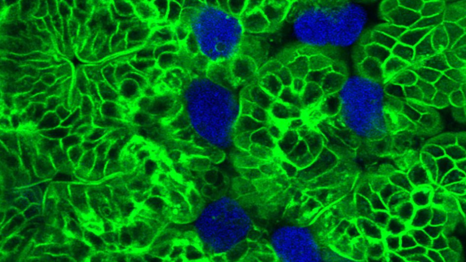 Entamoeba histolytica — одноклеточный паразит, который ежегодно заражает 50 млн человек Entamoeba histolytica — одноклеточный паразит, который ежегодно заражает 50 млн человек