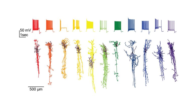 Нижний ряд – снимки различных видов нейронов. Верхний ряд – электрическая активность, записанная с каждого нейрона.