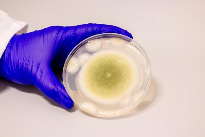 Образец Aspergillus flavus, культивированный в лаборатории Гао Образец Aspergillus flavus, культивированный в лаборатории Гао