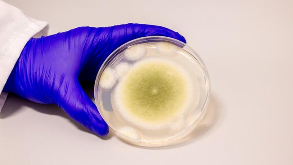 Образец Aspergillus flavus, культивированный в лаборатории Гао Образец Aspergillus flavus, культивированный в лаборатории Гао