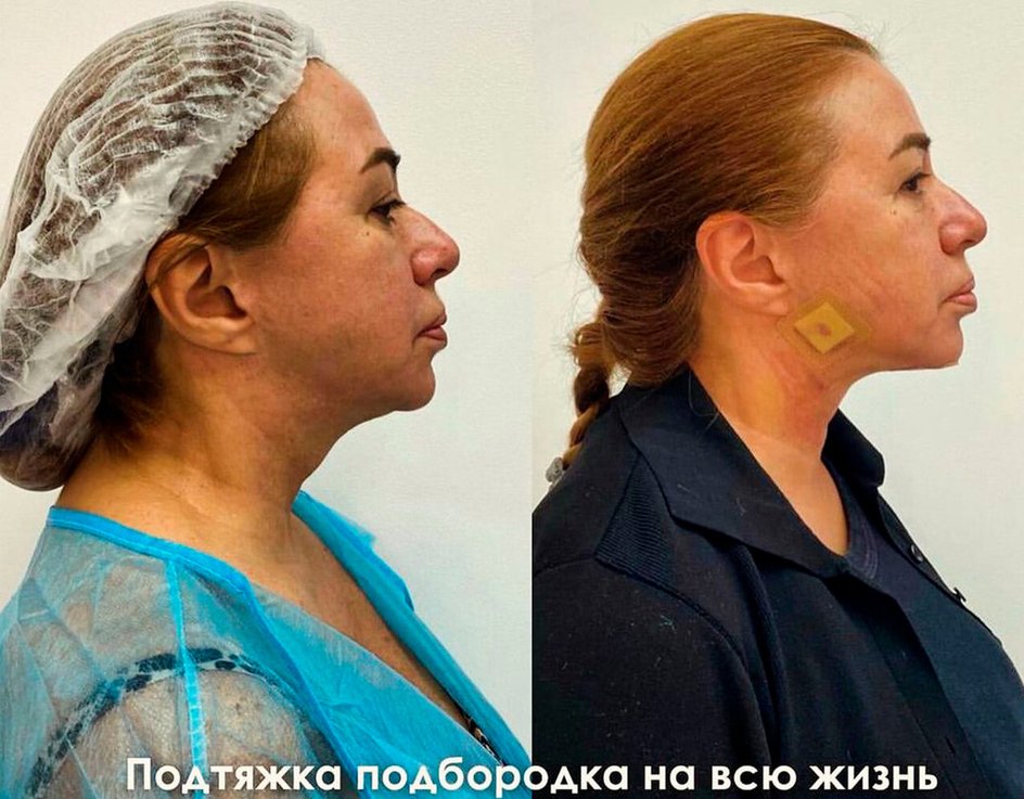 алена апина алена апина