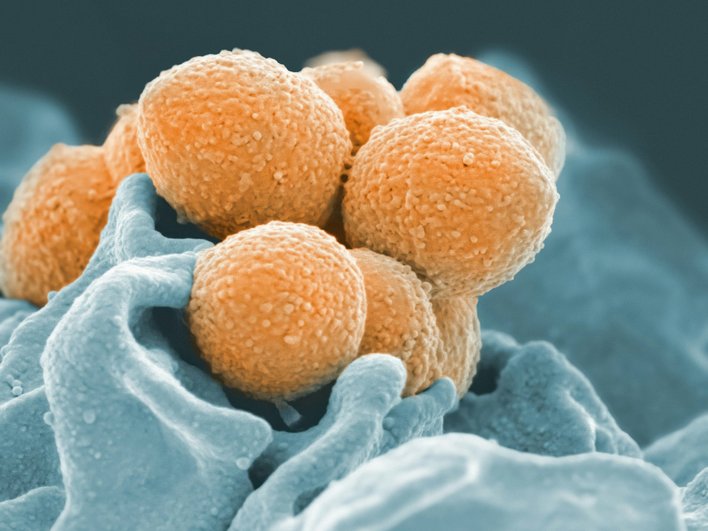 Streptococcus pyogenes под микроскопом Streptococcus pyogenes под микроскопом