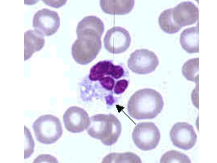 Бактерия Erlichiacanis Бактерия Erlichiacanis