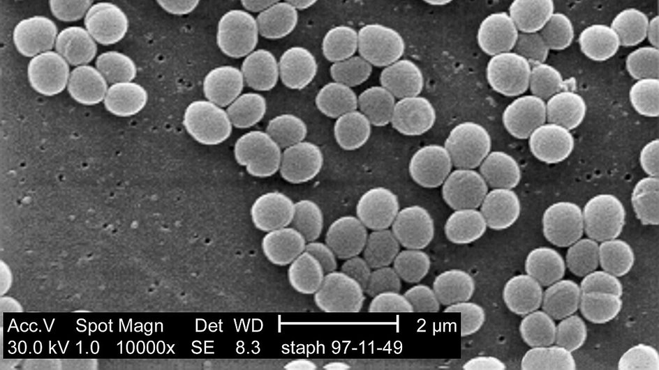 штамм бактерий Staphylococcus aureus штамм бактерий Staphylococcus aureus