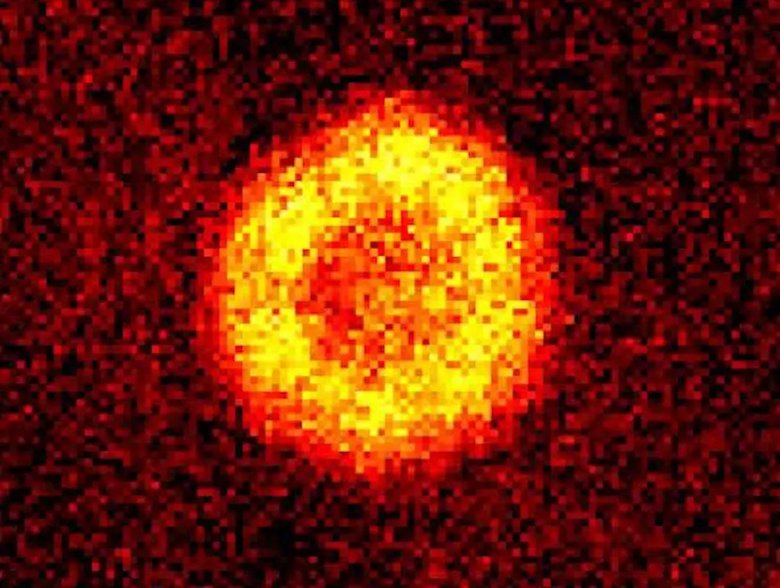 Изображение молекулярного конденсата Бозе-Эйнштейна под микроскопом. Фото: Chin Lab