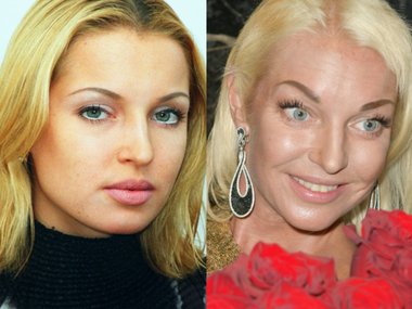 Slide image for gallery: 13913 | Анастасия Волочкова в 1999 году (слева) и в 2020 году (справа)
