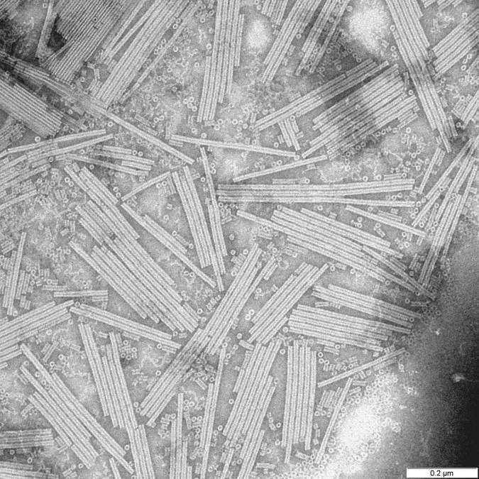 Вирус табачной мозаики. Фото: wikimedia / общественное достояние