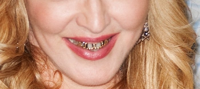 Мадонна сделала себе золотые зубы