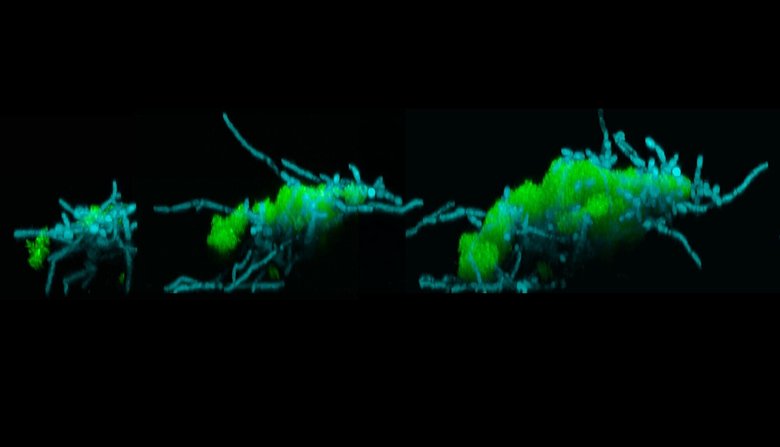 Микроскопические изображения недавно обнаруженных движущихся суперорганизмов. Они состоят из бактерий (зеленых), прикрепленных к ним грибков (синий). Фото: PNAS