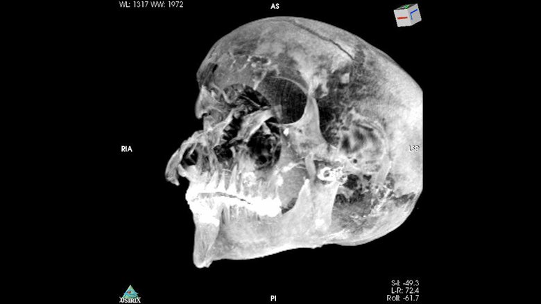 Трехмерное изображение показывает сильно поврежденный череп фараона. Фото: Sahar Saleem