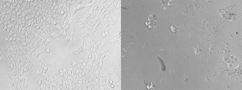 Эмбриональные клетки почек без обработки (слева) и обработанные микро- и нанопластиками (справа) в течение 72 часов. Источник: sciencealert.com