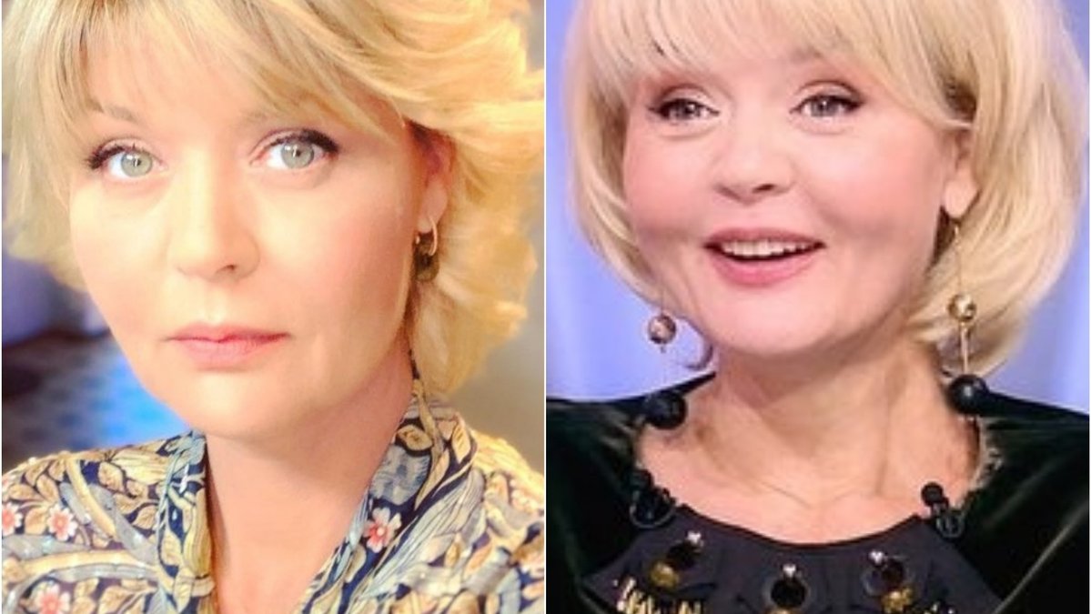 Юлия меньшова пластика лица фото до и после