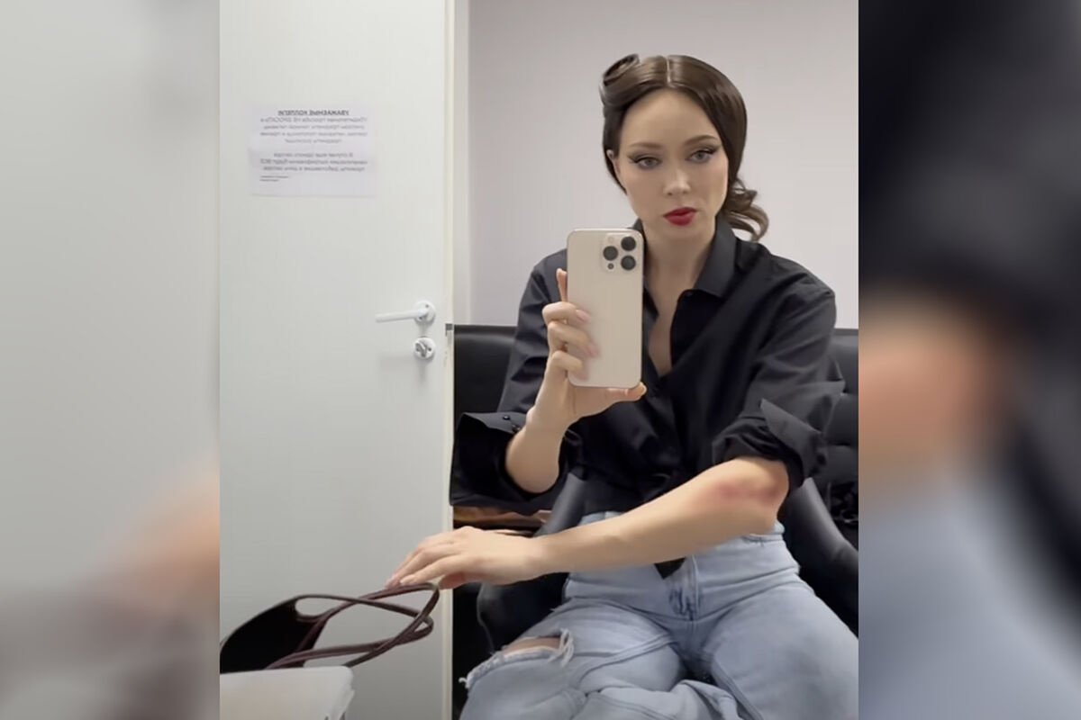 Настасья Самбурская показала травму, которую ей нанес Стас Костюшкин: "Сбил мопедист" Настасья Самбурская показала травму, которую ей нанес Стас Костюшкин: "Сбил мопедист"