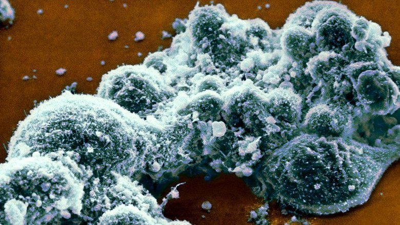Вирус герпеса делает мышей - и, очень возможно, людей - менее подверженными некоторым бактериальным инфекциям. Фото: SCIENCE PHOTO LIBRARY