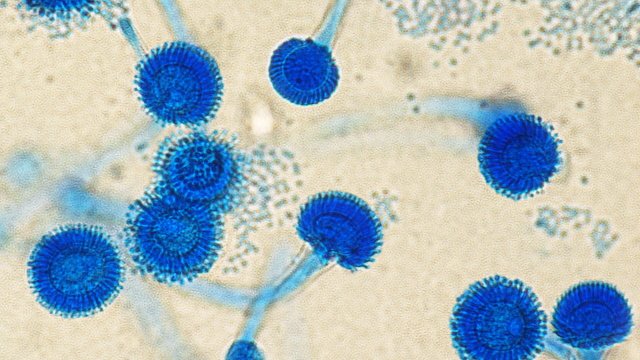 Грибок Aspergillus fumigatus Грибок Aspergillus fumigatus
