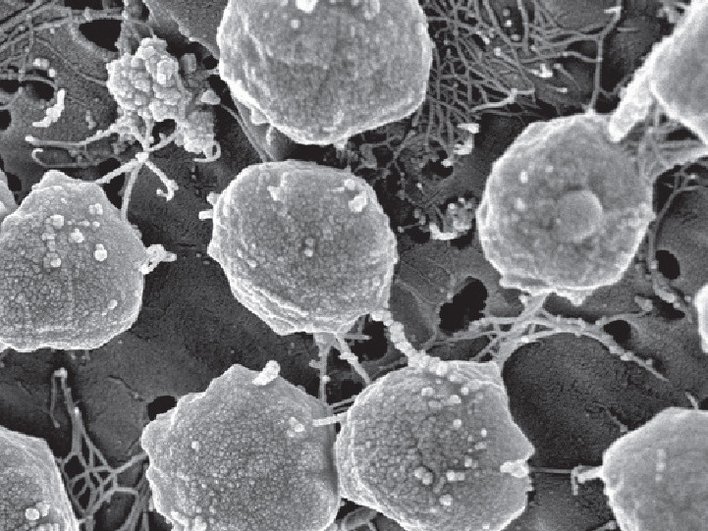 Археи Methanococcus jannaschii Археи Methanococcus jannaschii