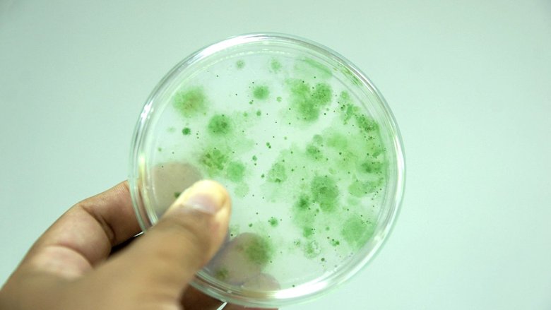 Цианобактерии на чашке Петри. Фото: Twita