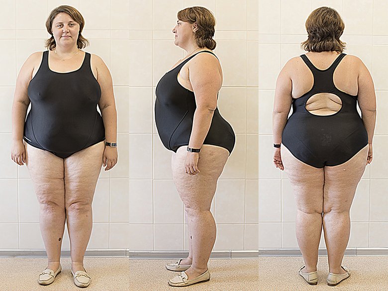 Олеся пробовала самые разные методы похудения, но заметного результата они не принесли