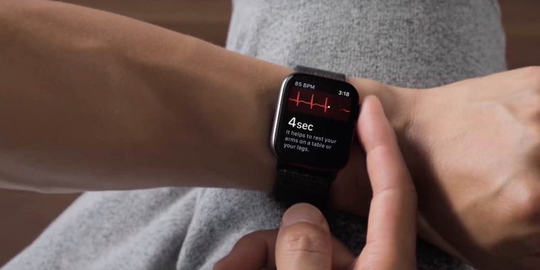 Так выглядит работа функции ЭКГ на Apple Watch