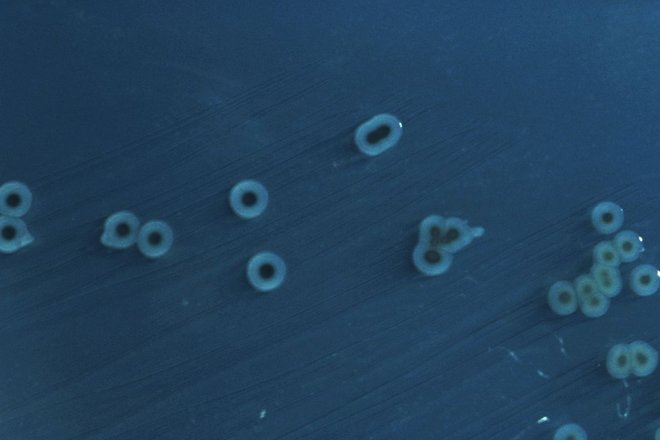 Salmonella enterica Salmonella enterica