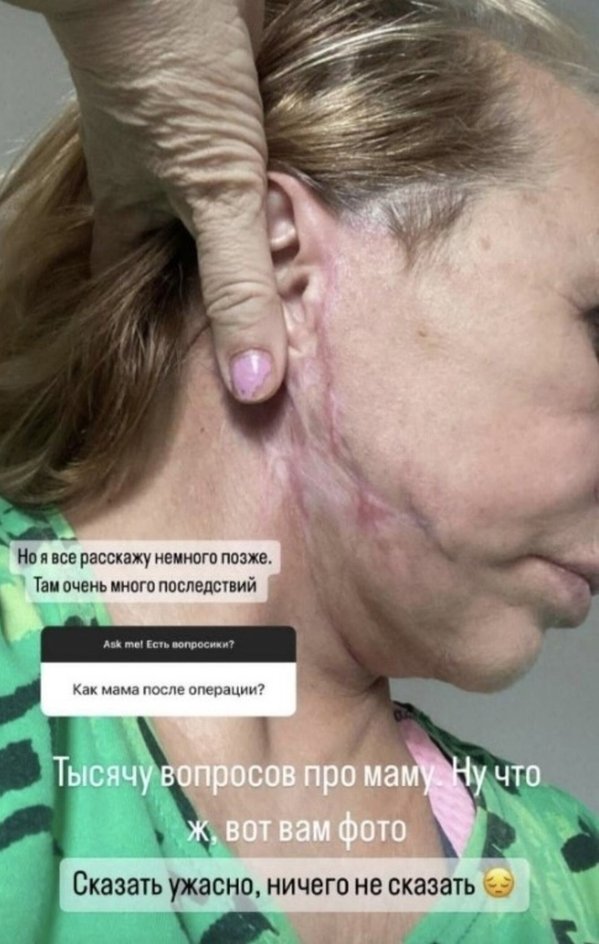 Виктория Боня показала маму после пластики Виктория Боня показала маму после пластики