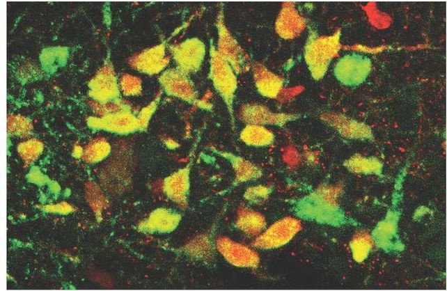 Нейроны дорсального шва. Красные клетки — это вирус, помеченный красным флуоресцентным белком